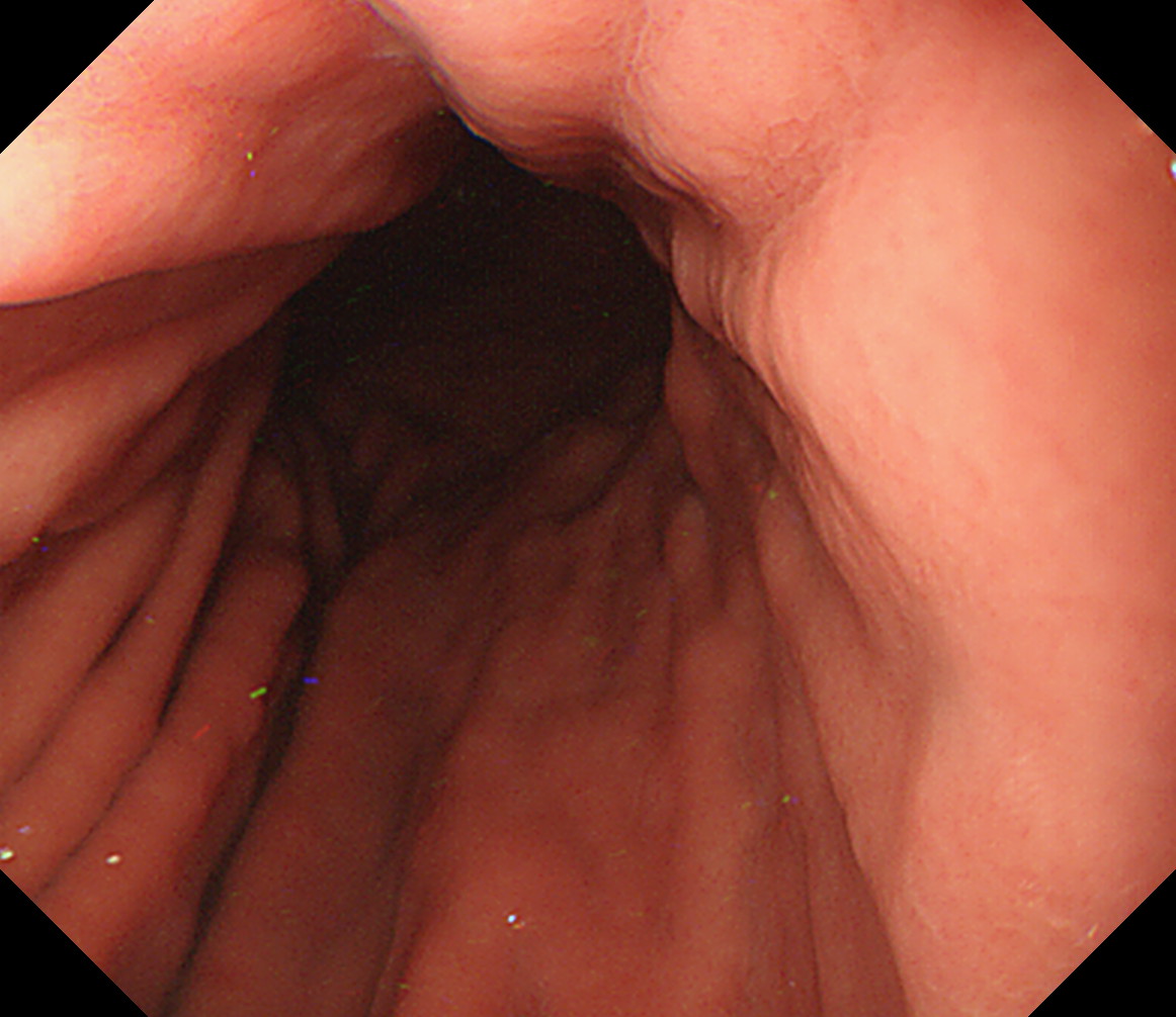 �̉������